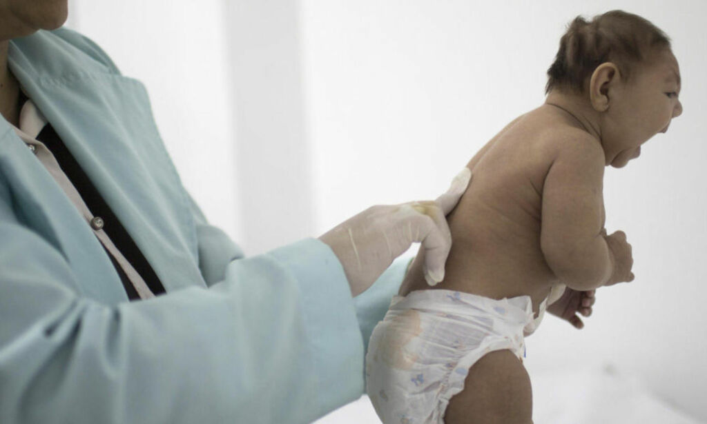 USA fastslår at zikavirus forårsaker fosterskader
