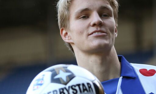 Klubben bekrefter: Ødegaard har pådratt seg beinbrudd