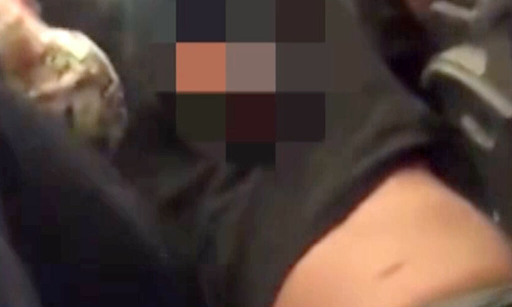 United Airlines-passasjer brakk nesen og pådro seg hjernerystelse