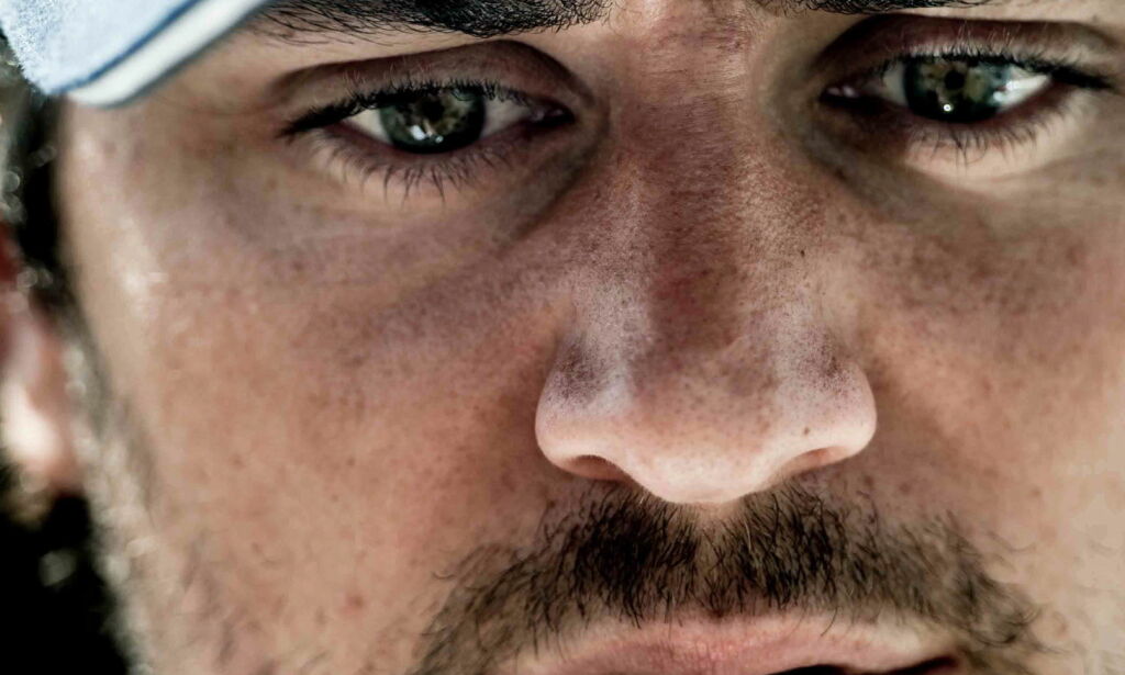Zuccarello sliter fortsatt, to år etter dramaet