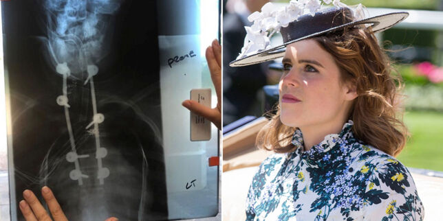 Prinsessa åpner opp om sykdommen